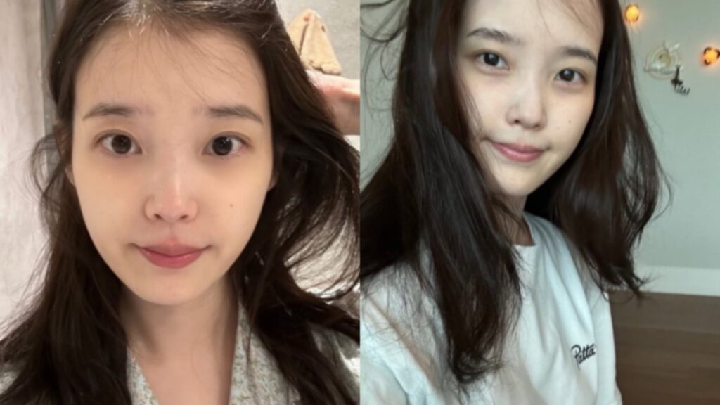 IU、耳管開放症悪化も笑顔で近況報告